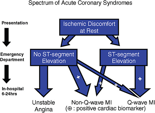 FIGURE 4-1 Classification system for the spectrum of acute coronary syndromes that helps practitioners identify a study population more easily.