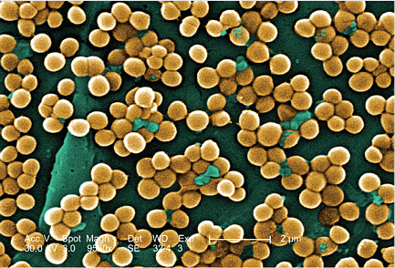 FIGURE WO-4-1 Methicillin-resistant Staphylococcus aureus.