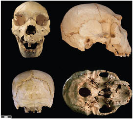 FIGURE 2.4 Sima de los Huesos (Atapuerca) cranium 5.