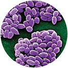Bacillus anthracis, the agent of anthrax.