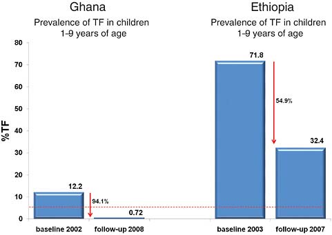 FIGURE A6-3 Prevalence of Trachomatus inflammation-follicular (TF) in children 1–9 years of age in Ghana and Ethiopia, 2007–2008.