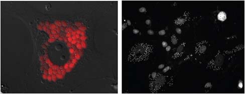 FIGURE A21-1 Amastigotes of T. cruzi within host cells. (left) CL strain parasites expressing the tandom Tomato red protein and useful for both in vitro and in vivo screening assays (Canavaci et al., 2010). (right) Example of high-content microscopic screening using DNA stains to detect T. cruzi replication within host cells.