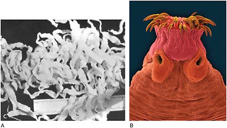 FIGURE WO-6-8 Cysticercosis. (A) Adult Taenia solium worm. (B) Mammal intestine tapeworm (Taenia spp.). The adult has a head (scolex) with suckers and/or hooks that are used to attach to the host (SEM 16x magnification).