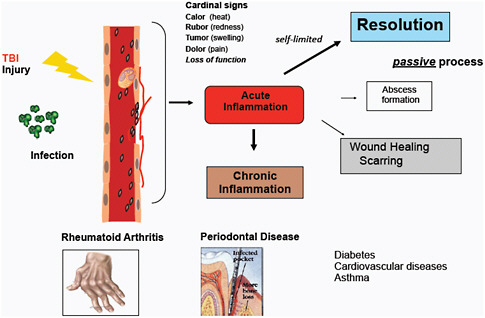 FIGURE C-10 Decision paths in acute inflammation. Several outcomes of acute inflammation caused by infection or injury are possible, including progression to chronic inflammation, tissue fibrosis and wound healing/scarring or, in the ideal scenario, complete resolution (Majno, 1975). The cardinal signs of inflammation—calor (heat), rubor (redness), tumor (swelling), dolor (pain), and loss of function—have been known as the visual signs of inflammation apparent to ancient civilizations. Chronic inflammation was viewed as the persistence of an acute inflammatory response. The chronic inflammatory diseases widely observed in the West are rheumatoid arthritis and periodontal disease. There is now considerable interest in inflammation because it is considered to be the pathophysiologic basis of many diseases that were traditionally not considered to be inflammatory in their pathobiology. These include diabetes, cardiovascular diseases, and asthma, to name a few.