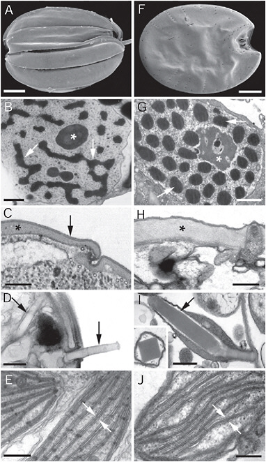 FIGURE 4.2 Electron micrographs showing convergent ultrastructural features in some euglenozoans (A–E) and dinoflagellates (F–J). (A) Scanning electron micrograph (SEM) of a benthic euglenid (Ploeotia) showing a dorsoventrally compressed cell with broad longitudinallyarranged pellicle strips. (B) Transmission electron micrograph (TEM) through the nucleus of a euglenid cell (Phacus) showing a large nucleolus (asterisk) and permanently condensed chromosomes (arrows). (C) TEM through the cell surface or pellicle of a euglenid cell showing the proteinaceous strips (asterisk) beneath the plasma membrane (arrow). (D) TEM through the cell surface of a euglenid cell (Peranema) showing mucocysts (arrows). (E) TEM through a euglenophyte cell (Euglena) showing chloroplasts with thylacoids in stacks of 3 (stack between the arrows). (F) SEM of a benthic dinoflagellate (Prorocentrum) showing a dorsoventrally compressed cell with broad thecal plates. (G) TEM through the nucleus of a dinoflagellate cell (Apicoporus) showing a large nucleolus (asterisk) and permanently condensed chromosomes (arrows). (H) TEM through the cell surface of a dinoflagellate cell (Apicoporus) showing the proteinaceous “dinoflagellate pellicle” (asterisk) that sits beneath the alveoli and plasma membrane (both missing in this preparation). (I) TEM through the cell surface of a dinoflagellate cell (Polykrikos) showing trichocysts (arrows). (Inset) TEM showing a cross section through a trichocyst of Polykrikos. (J) TEM through a dinoflagellate cell (Apicoporus) showing chloroplasts with thylacoids in stacks of 3 (stack between the arrows). (Scale bars: A and F, 10 μm; B and G, 1 μm; C, H, and J, 0.3 μm; D, E, and I, and 0.5 μm.)
