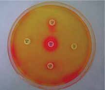 FIGURE WO-4-5 Detection of extended-spectrum β-lactamase production by the double disk test on DSM-ES agar. Disks: center, amoxycillin + clavulanate 20 + 10 μg; right, cefepime 30 μg; left, ceftriaxone 30 μg; top, ceftazidime 30 μg; bottom, aztreonam 30 μg.