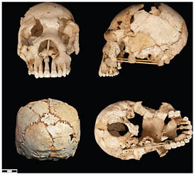 FIGURE 2.5 Sima de los Huesos (Atapuerca) cranium 6.