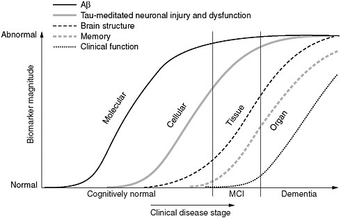 FIGURE 2 Maximizing the value of the Alzheimer’s Disease Neuroimaging Initiative. Reverse translation approach to development of diagnostics and preventative medicine for Alzheimer’s disease as envisioned for J-ADNI 2.