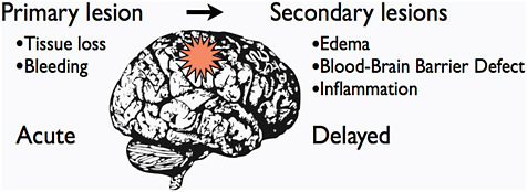 FIGURE C-4 A schematic representation of the relation between primary and secondary traumatic brain damage after TBI. The interval between the primary acute lesion and the secondary lesions can vary from hours to days.