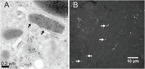 FIGURE A8-2 Visualization of Coxiella-type symbiont from A. americanum. (A) Transmission electron microscopy of thin sectioned ovarian tissue from a engorged female. Arrows demarcate presumptive outer and inner membrane structures (B) FISH microscopy of tissue section from a dissected ovary A. americanum show oocytes stained with a Coxiella-specific probe labeled with Cy5. Arrows highlight fluorescent punta resulting from probing and indicate of the Coxiella-type symbiont.