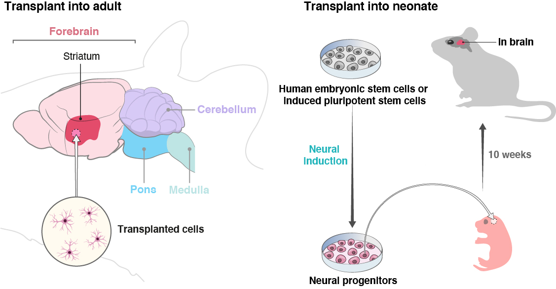 Human neural transplants